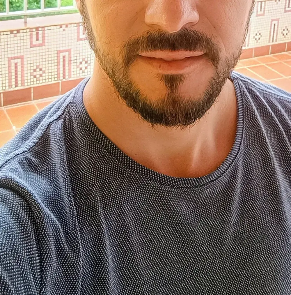 CasosAM